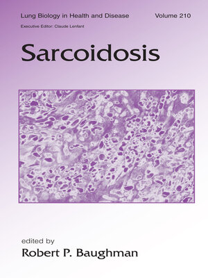 cover image of Sarcoidosis
